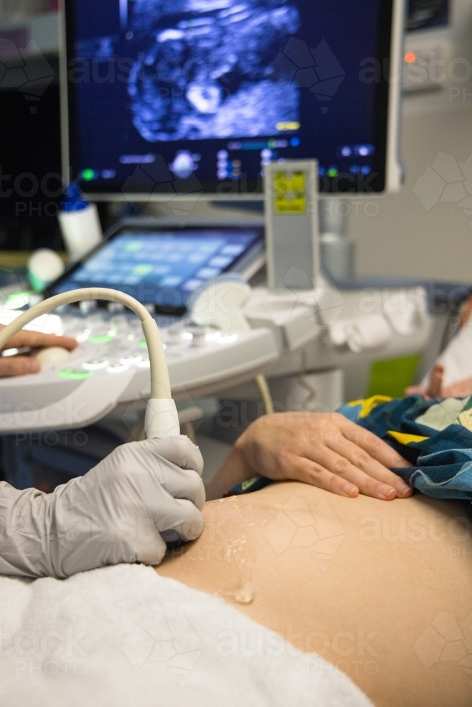 A female having an ultrasound performed on her abdomen - Australian Stock Image