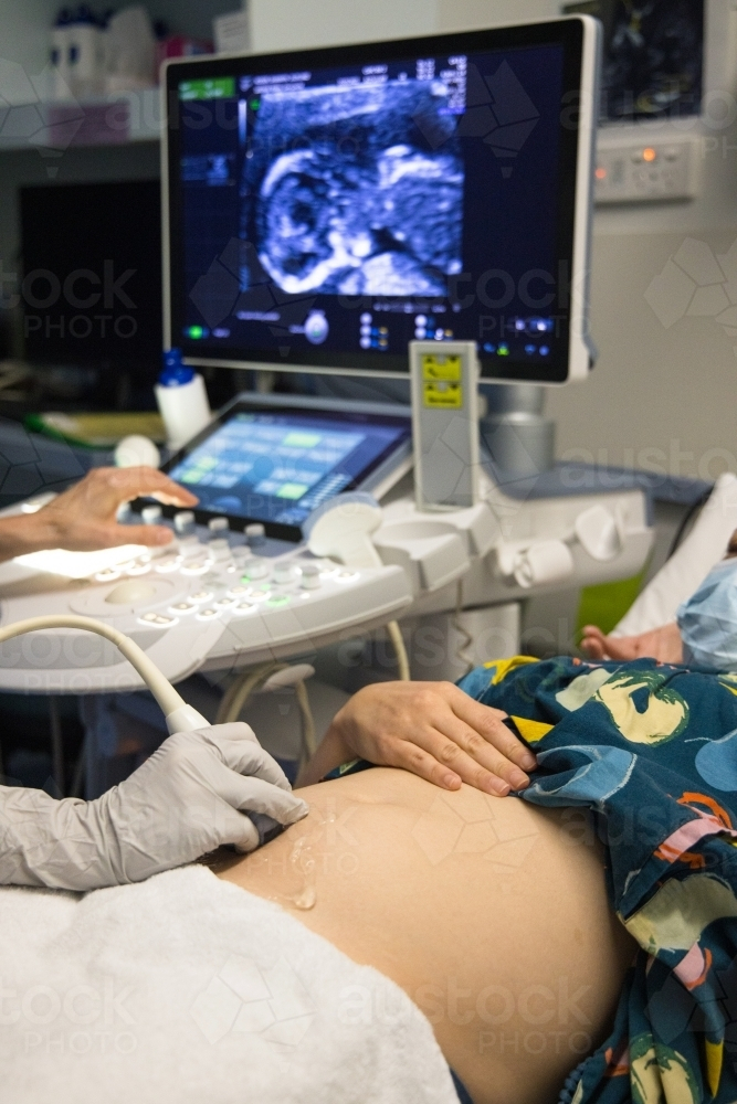 A female having an ultrasound performed on her abdomen - Australian Stock Image