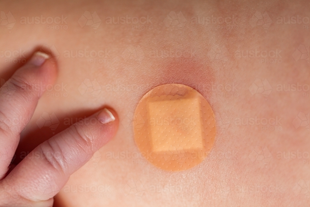 Baby fingers beside band aid over vaccination injection site - Australian Stock Image