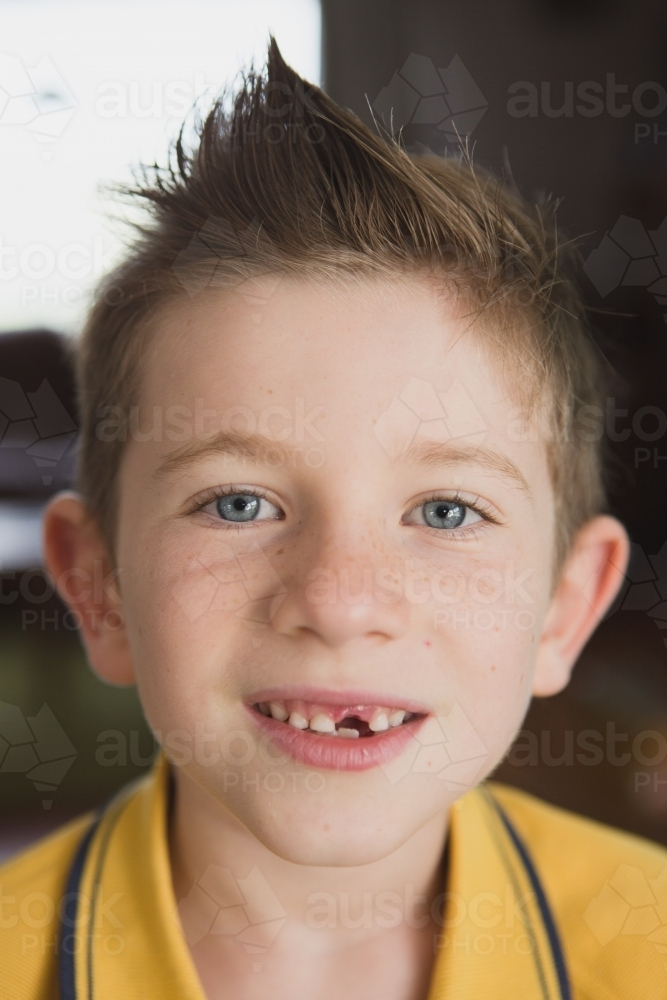 Boy with missing tooth smiling - Australian Stock Image