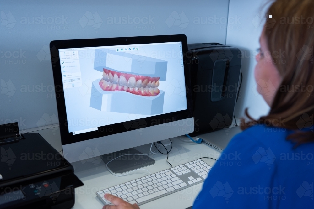 Digital intraoral scanner view of teeth on a monitor - Australian Stock Image