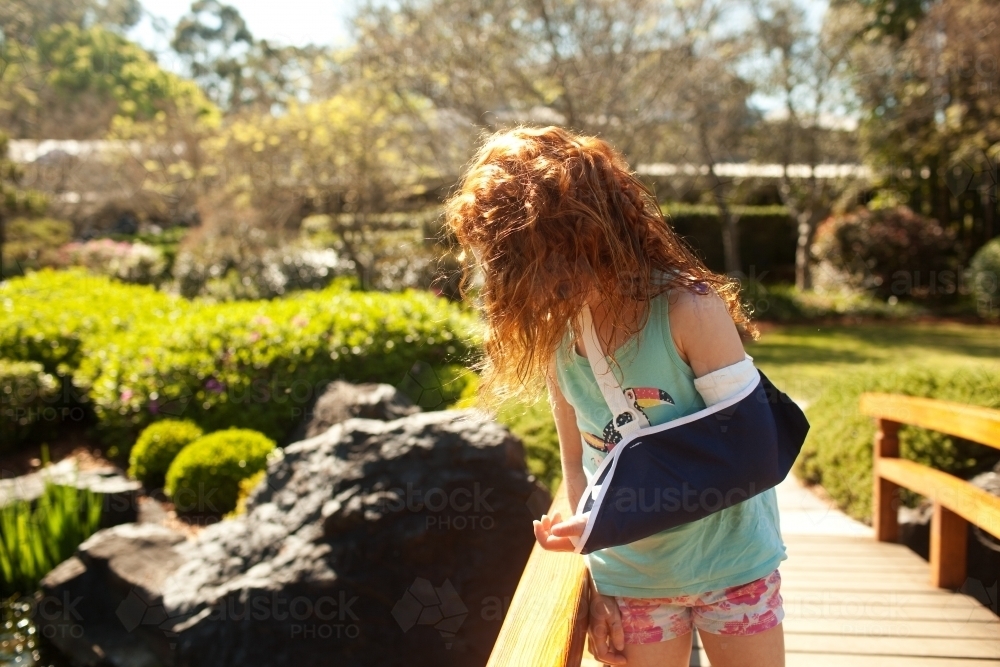 Girl with a broken arm looking over a bridge - Australian Stock Image