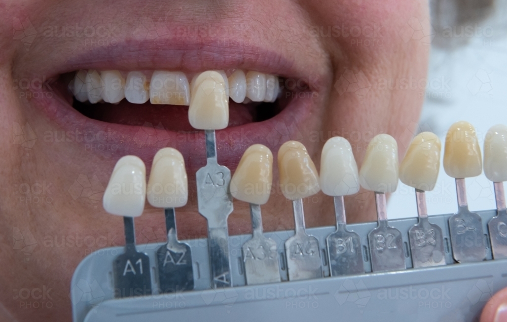 image-of-matching-teeth-colour-with-tooth-shade-guide-austockphoto