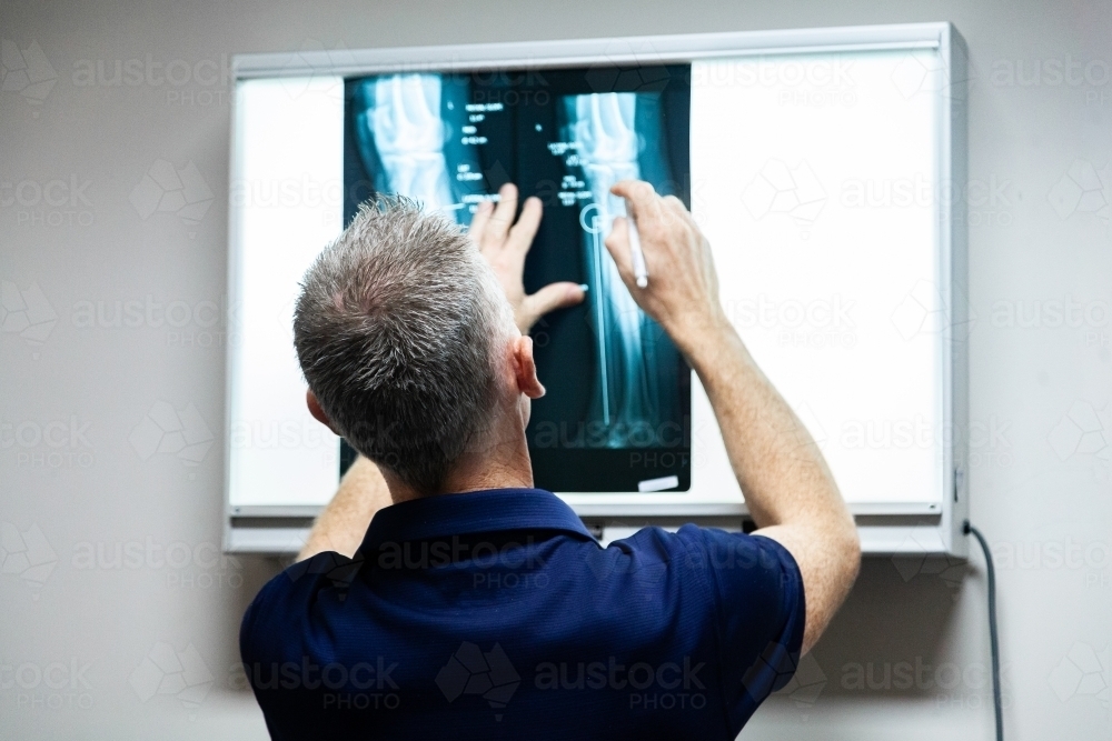 Medical practitioner looking at x-ray, talking through it with client - Australian Stock Image