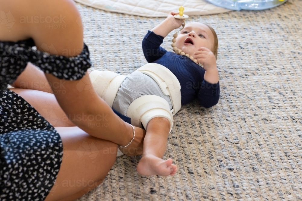 mother applying hip abduction brace to baby with hip dysplasia - Australian Stock Image