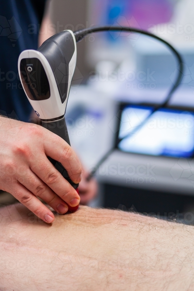 shock wave therapy machine being used to promote healing of scar on leg - Australian Stock Image