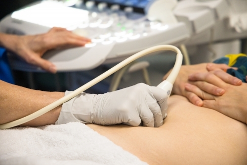 A female having an ultrasound performed on her abdomen - Australian Stock Image