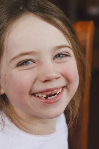 Close up of a young girl with two front teeth missing - Australian Stock Image