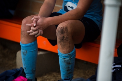 Dirty Soccer Knees - Australian Stock Image