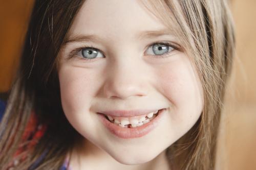 Little girl first lost tooth - Australian Stock Image