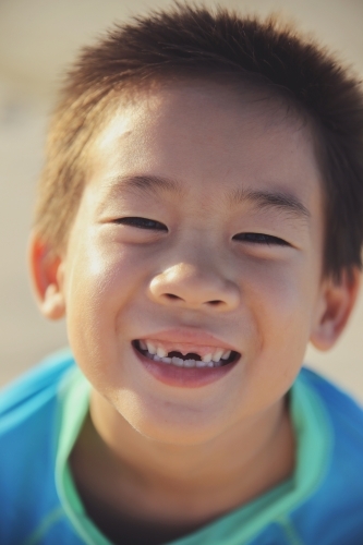 Young boy lost front teeth - Australian Stock Image