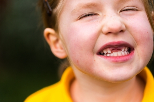 Young school girl showing her missing front teeth - Australian Stock Image